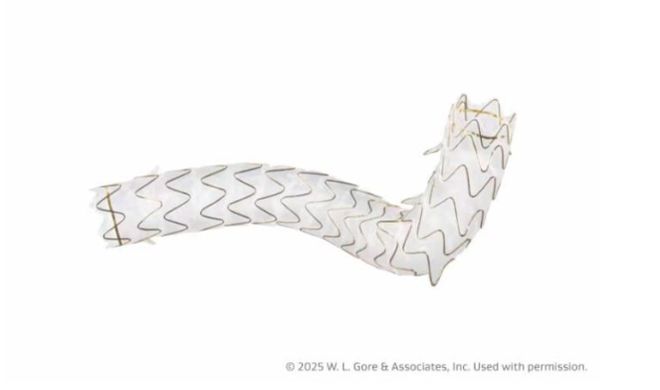 骨科龙头退出奥林巴斯接手(图1)