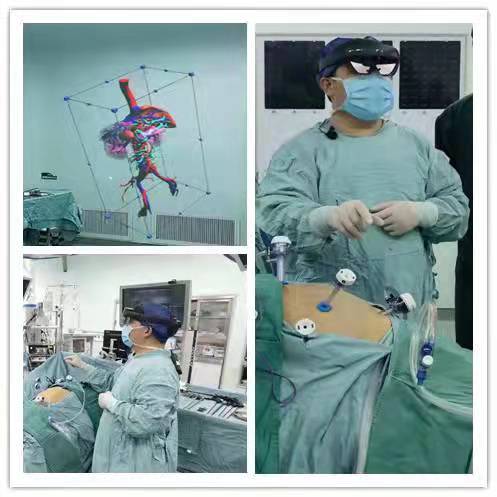 宫外孕腹腔镜手术步骤